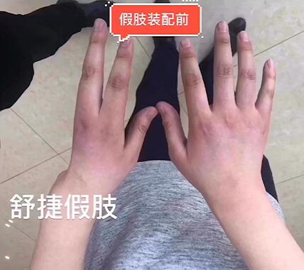 假手指