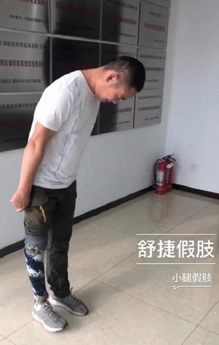 5万小腿假肢