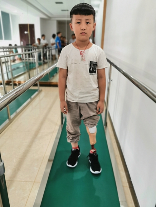 小腿假肢价格