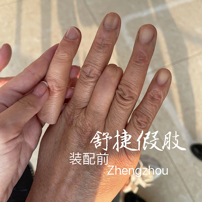 假手指装配前.jpg