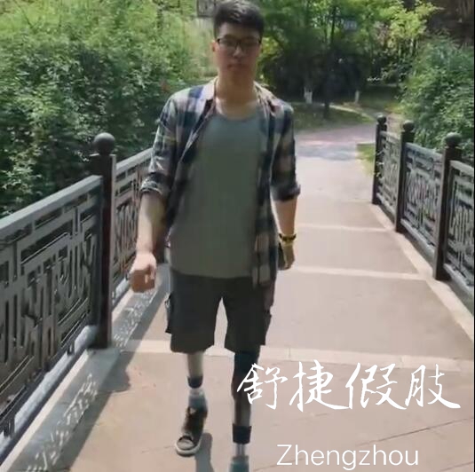 双大腿假肢装配正常