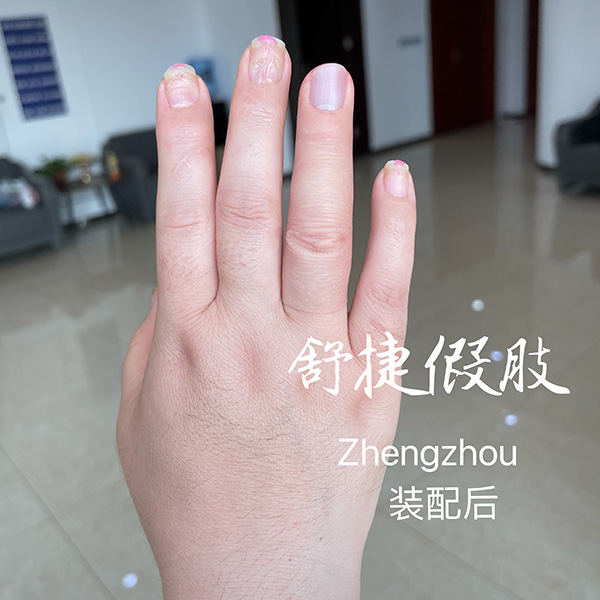 美容假手指装配后效果图3.jpg
