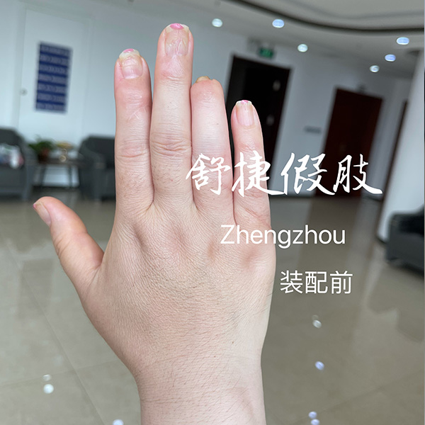 美容假手指装配前