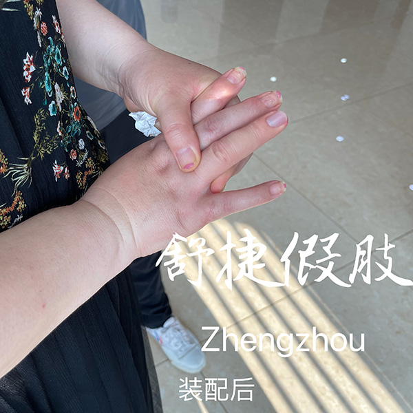 美容手指.jpg 美容手指.jpg